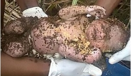 Bé sơ sinh sống sót kỳ diệu dù bị mẹ chôn sống suốt 3 ngày