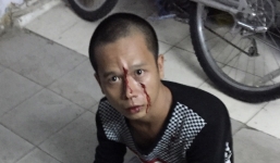 Hy hữu tên cướp bị 'tóm gọn' vì chạy vào điểm kẹt xe