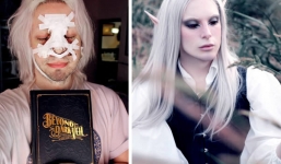 7 ca phẫu thuật thẩm mỹ kỳ lạ và quái đản nhất thế giới