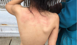 Bé gái bị lột trần đuổi ra khỏi nhà vì nhầm lịch thi gây bức xúc