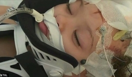 Bé gái 2 tuổi tổn thương não vì bị bảo mẫu là một cậu thiếu niên 16 tuổi trừng phạt