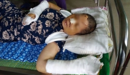 Chồng cuồng ghen, đánh vợ như thời trung cổ rồi cắt tay tự tử