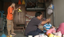 Bố nuôi 2 con bại não bi kịch hóa cuộc đời 'mua' lòng thương hại