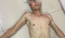 Giải cứu cô gái trẻ bị đối tượng nghi 'ngáo đá' không chế trong nhà nghỉ