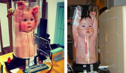 Em bé bị nhét vào bình thủy tinh, nhưng bác sĩ nói vì để tốt cho chúng khiến nhiều người bất ngờ