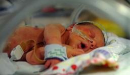 Mẹ quyết định sinh con chỉ có nửa quả tim và cái kết trọn vẹn