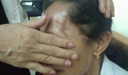 Người đàn bà 2 lần mổ não do tai biến, khỏe lại thần kỳ nhờ lọ thuốc gia truyền