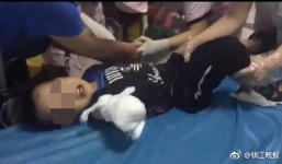 Vấp ngã khi đi ngược chiều, bé trai 4 tuổi bị thang cuốn nghiến đứt lìa cánh tay