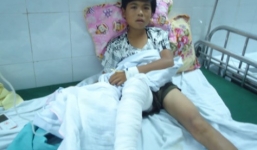 Nam sinh bị hổ vồ mất bắp chân ở Thanh Hóa