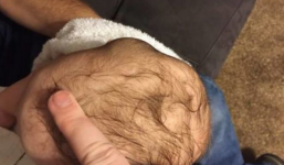 Đầu con biến dạng khi đi nhà trẻ, mẹ đến gặp bác sĩ và nhận được tin sét đánh