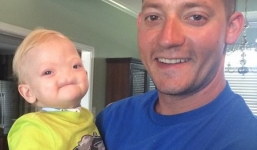 Bé trai không có mũi qua đời ở tuổi lên 2