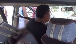 Người đàn ông may mắn sống sót sau khi bị thanh sắt xuyên thủng người