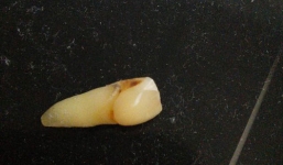 Rơi răng tại hiện trường, tên trộm nhận cái kết không thể 'đắng' hơn