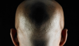 Hãi hùng vụ đàn ông đầu trọc bị săn để sát hại, cướp vàng trong đầu