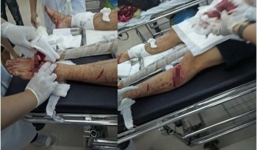 Nhóm côn đồ chém gục đối thủ trong cửa hàng mỹ phẩm