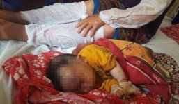 Nổ khí ga, 10 người trong một gia đình bị bỏng nặng