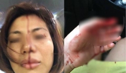 Vợ 'tố' bị chồng cũ bạo hành, ép 'quan hệ' 5 tiếng mới cho đi làm