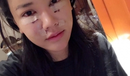 Maya lần đầu khoe nhan sắc sau 22 ngày phẫu thuật thẩm mỹ