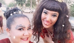 Bị người yêu bỏ rơi vì nhan sắc 'phù thủy cũng giật mình', cô gái phẫu thuật thẩm mỹ thành hot girl quyến rũ