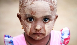 Nếu ánh mắt đứa trẻ biết nói, chúng sẽ nói về nỗi khổ của cuộc đời tị nạn không biết đến niềm vui