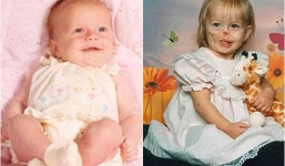 Phẫu thuật khôi phục gương mặt cho cô bé bị gấu trúc cào nát mặt cách đây 14 năm 