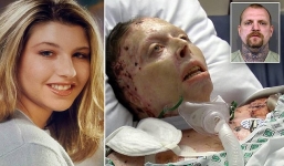 2 năm sau khi bị bạn trai tẩm xăng thiêu sống, người phụ nữ xinh đẹp đã qua đời