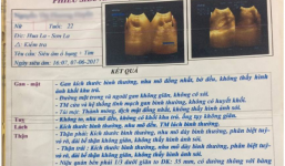 Mang trong mình 3 quả thận, 3 niệu quản, cô gái trẻ có thể mất chức năng thận và ung thư