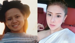 Cuộc sống của cô gái 'đập mặt đi làm lại'