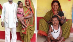 Người đàn ông 50 tuổi 'mắc kẹt' trong hình hài em bé 5 tuổi