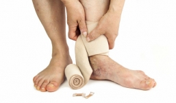 Những dấu hiệu cảnh báo căn bệnh đông máu đang 'rình rập' đe dọa bạn