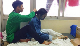 Bức ảnh dễ thương về chàng trai ngồi tết tóc cho người yêu bị thủy đậu: Yêu là luôn bên nhau cả khi xấu xí nhất