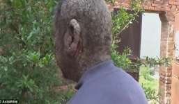 Cám cảnh 'dị nhân' cả đời không thể kết hôn và bị dân làng xa lánh