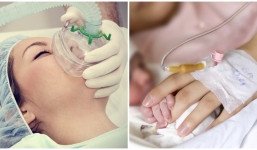 Các mẹ biết gì về gây mê nội khí quản - Phương pháp được khuyến cáo thay thế gây tê tủy sống trong sinh mổ