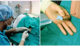 Tất tần tật những tác dụng phụ của gây tê tủy sống khi sinh mổ mẹ không thể làm ngơ