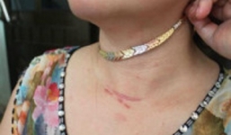 Người phụ nữ bị bóp cổ, cướp dây chuyền vàng ngay trong nhà mình