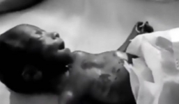 Bé gái sinh non bất ngờ 'sống lại' trong đám tang của mình