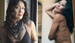 Sở hữu vẻ ngoài không mấy ưa nhìn, cô gái 26 tuổi đã thay đổi cả quan niệm về tiêu chuẩn sắc đẹp