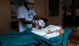 Mua phân bón trên mạng về tự chế, thiếu niên bị cụt 2 tay