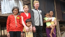 Kỳ lạ chị em người Ca Dong ở Quảng Nam bị xua đuổi, nhà chồng chì chiết vì giống hệt Tây