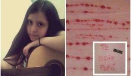 Cô bé tự lấy dao rạch khắp cơ thể và nỗi đau bị bố đẻ xâm hại từ năm 4 tuổi