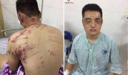 Làm rõ vụ nhóm côn đồ hành hung khiến 4 người nhập viện