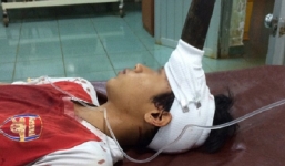 Cứu sống bé trai 12 tuổi bị dao cắm giữa trán