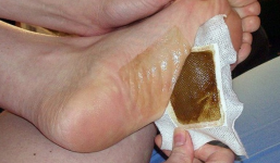 Sự thật về miếng dán chân 'thần thánh' giúp chị em giảm cân gây sốt