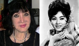 Sự thật gương mặt NSƯT Thẩm Thúy chảy nước do biến chứng phẫu thuật thẩm mỹ