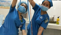 Hy hữu bé gái chào đời với dây rốn dài hơn 1m, quấn cổ 4 vòng