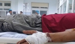 Hai chủ tàu tranh giành khách du lịch chém nhau gần đứt lìa bàn tay