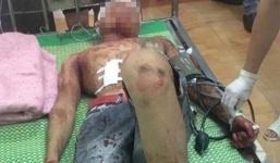 30 côn đồ truy sát kinh hoàng trong đêm, 3 người trọng thương
