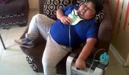 Hy hữu cậu bé 10 tuổi nặng 90 cân vì ăn không ngừng nghỉ