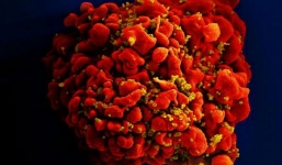 Ca nhiễm virus HIV được chữa khỏi thứ 3 trên thế giới