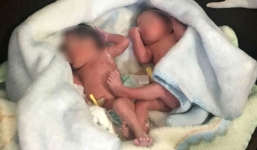 Phát hiện cặp song sinh còn nguyên dây rốn bị vứt trong bụi cây